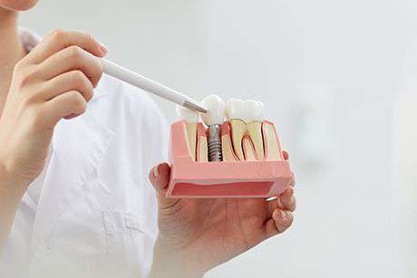 Protetik Diş Tedavisi